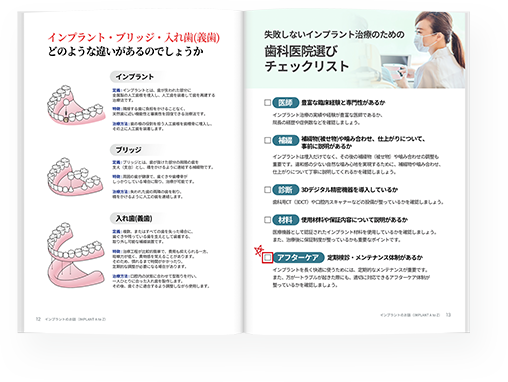 インプラントのお話 冊子の内容