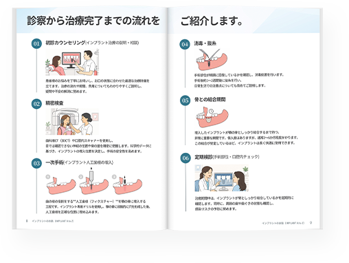 インプラントのお話 歯科医院の選び方